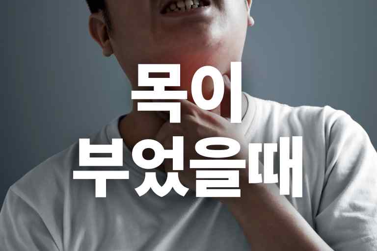 목 부었 을 때 빨리 낫는 법 7가지, 호전되는 음식